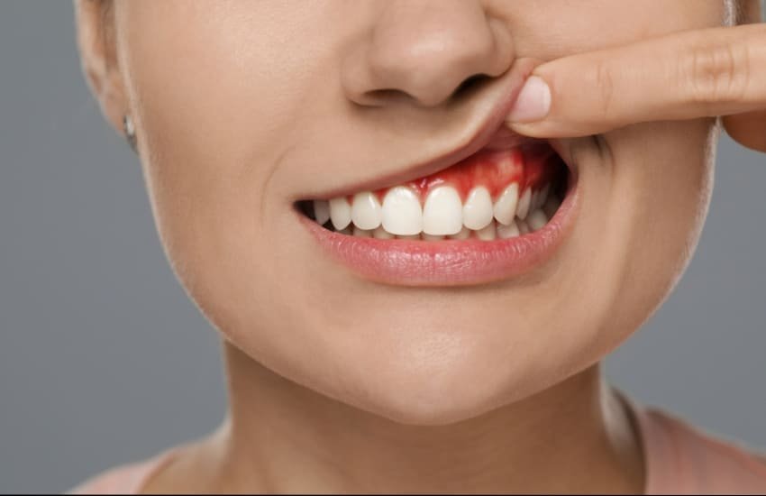 Professional gum treatment and deep cleaning at Sharjah dental clinic