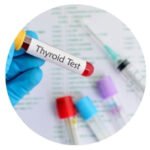 Thyroid checkup package in Sharjah offering TSH, Free T3, Free T4, vitals, and BMI tests with free doctor consultation at Shifa Al Jazeerah Medical Centre.